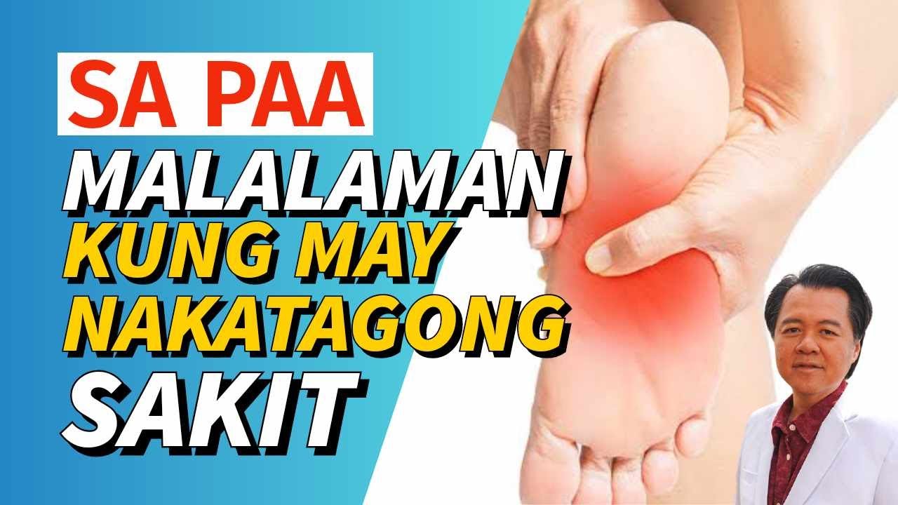 Sa Paa Malalaman kung may Nakatagong Sakit. - By Doc Willie Ong