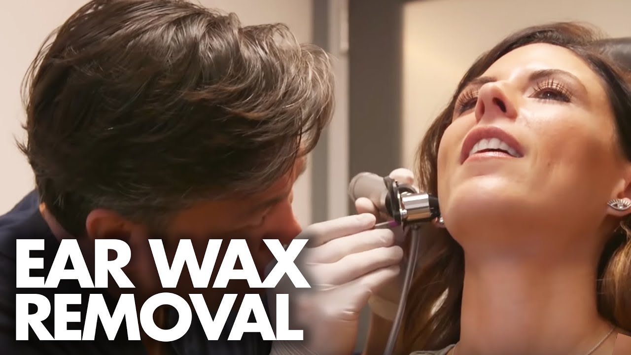 MEDICAL EAR WAX EXTRACTION (Beauty Trippin)