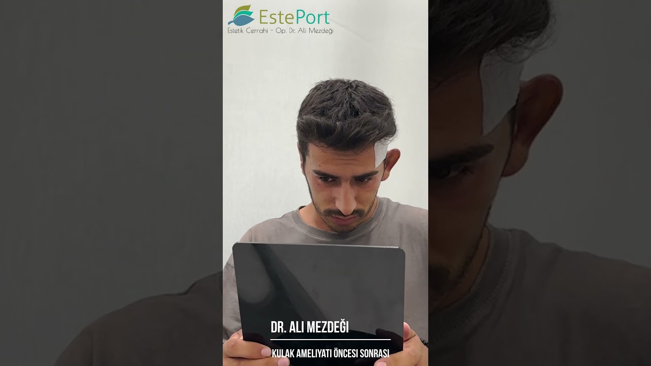 Kep&ccedil;e Kulak Ameliyatı &Ouml;ncesi ve Sonrası | &Ccedil;apa Tekniği ile Otoplasti