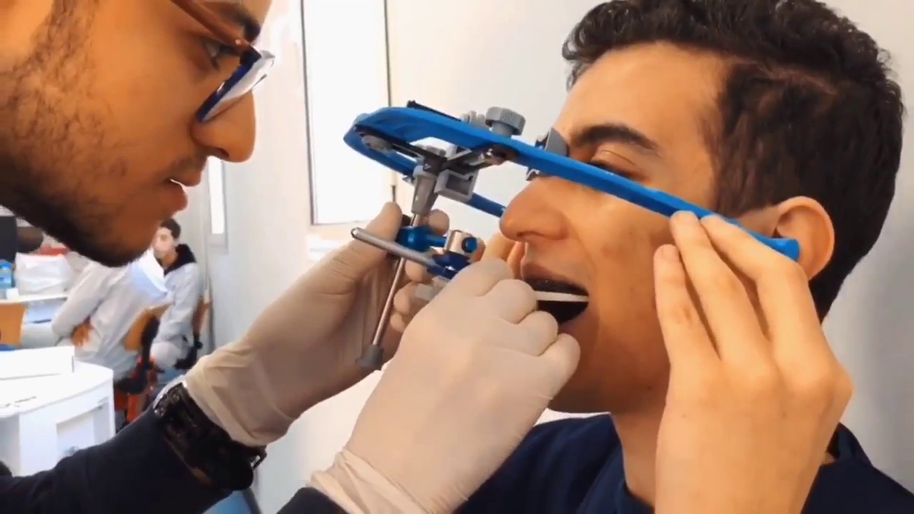 ARC FACIAL