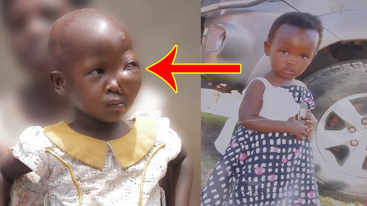 Yandwara itumye uyu mwana bagiye kumukuramo ijisho | Twarize Twese Tumubonye | Biteye ubwoba