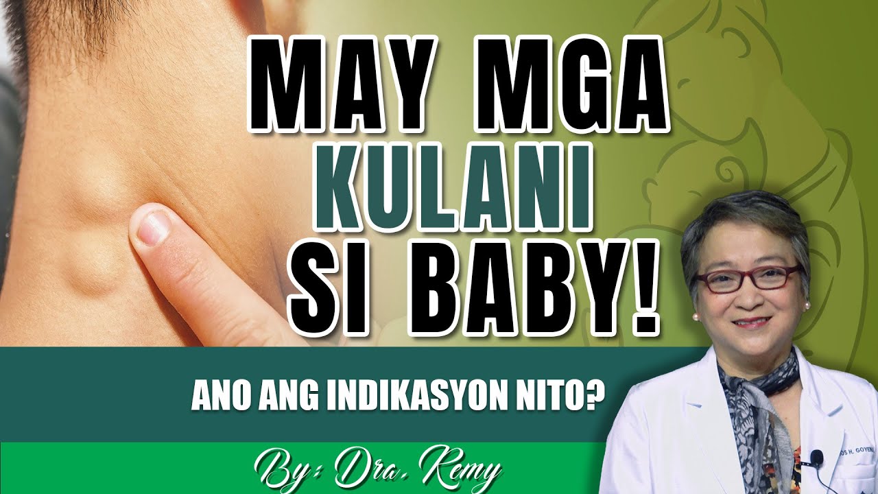 MAY MGA KULANI SI BABY!