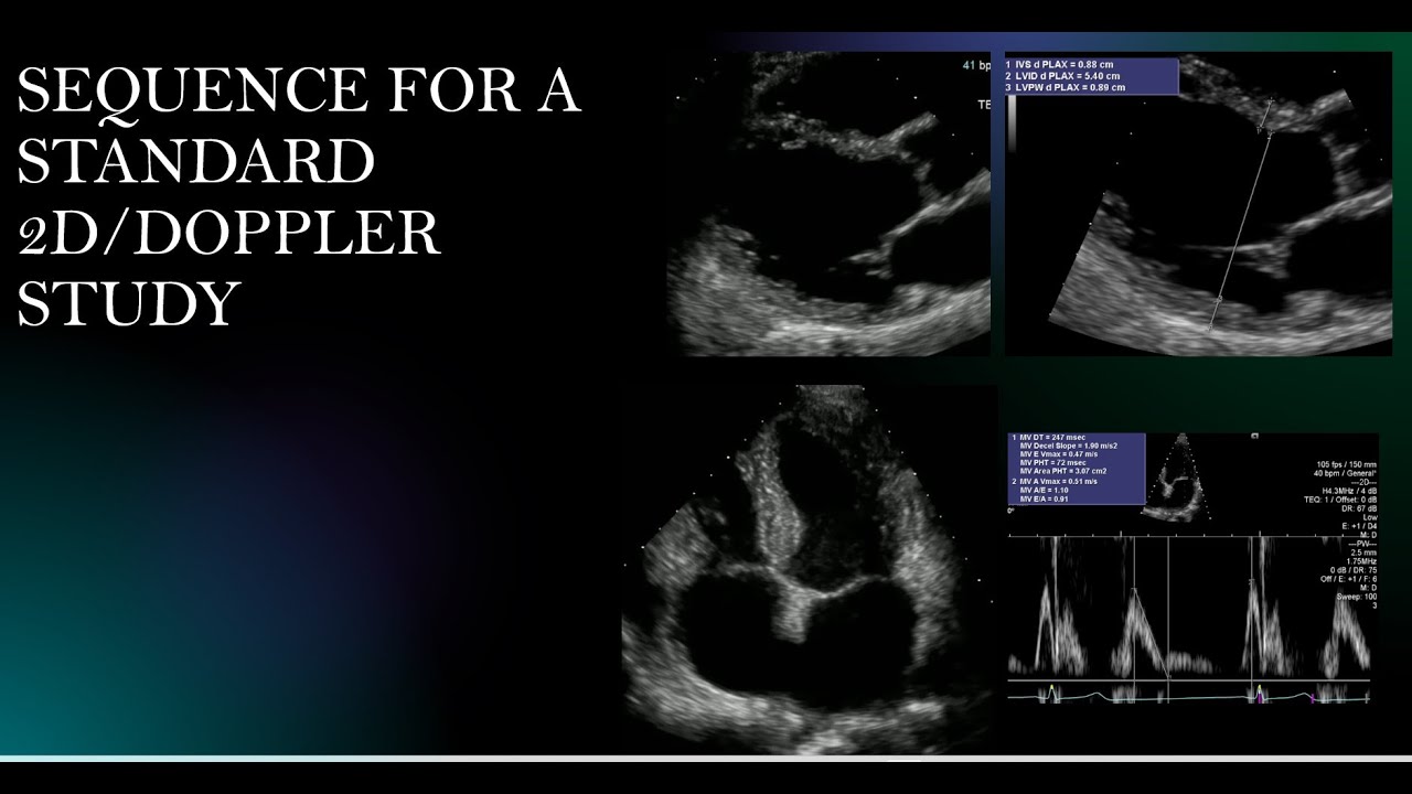 Standard Echo Images and Measurements