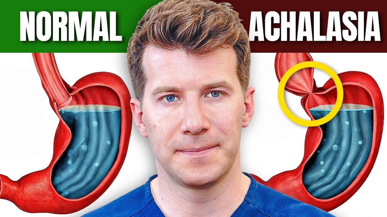 Doctor explains Achalasia | Causes, symptoms, treatment, surgery
