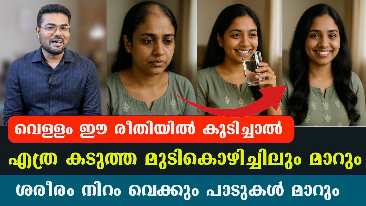 വെള്ളം ഈ രീതിയിൽ കുടിച്ചാൽ എത്ര കടുത്ത മുടികൊഴിച്ചിലും മാറും .ശരീരം നിറം വെക്കും / Dr Manoj Johnson