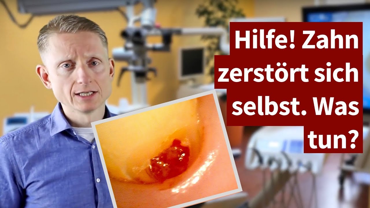 Zahn zerst&ouml;rt sich selbst. Kann ihn eine Wurzelbehandlung retten?