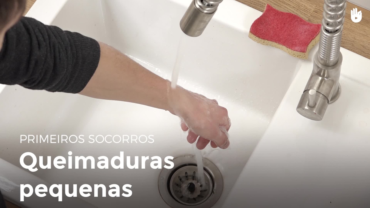 Queimaduras pequenas | Primeiros socorros
