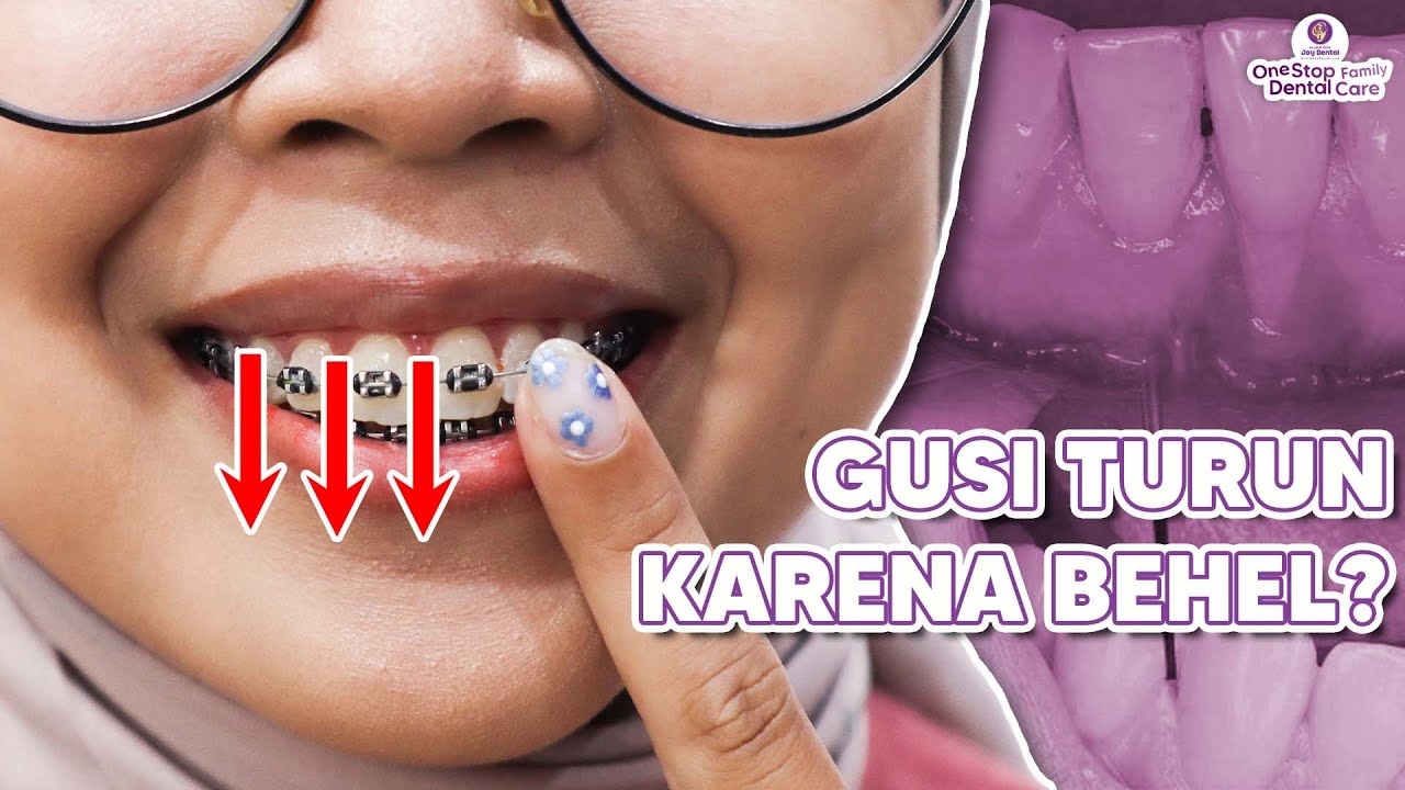 MITOS ATAU FAKTA?!! BEHEL BIKIN GUSI TURUN?