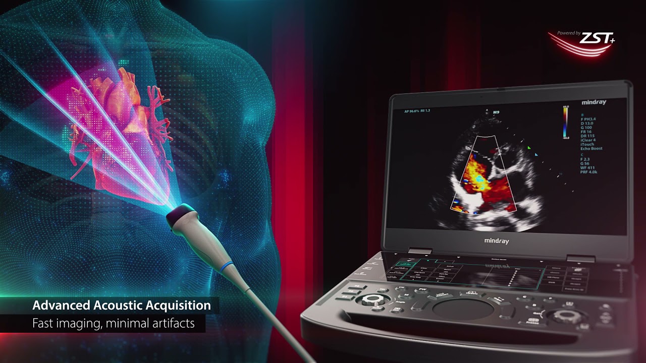 Mindray ME7 Portable Ultrasound