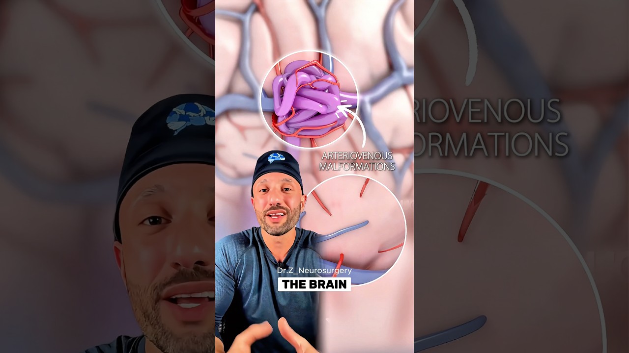 It&rsquo;s one of the most dangerous conditions that we can operate on #Surgery #Science #Interesting