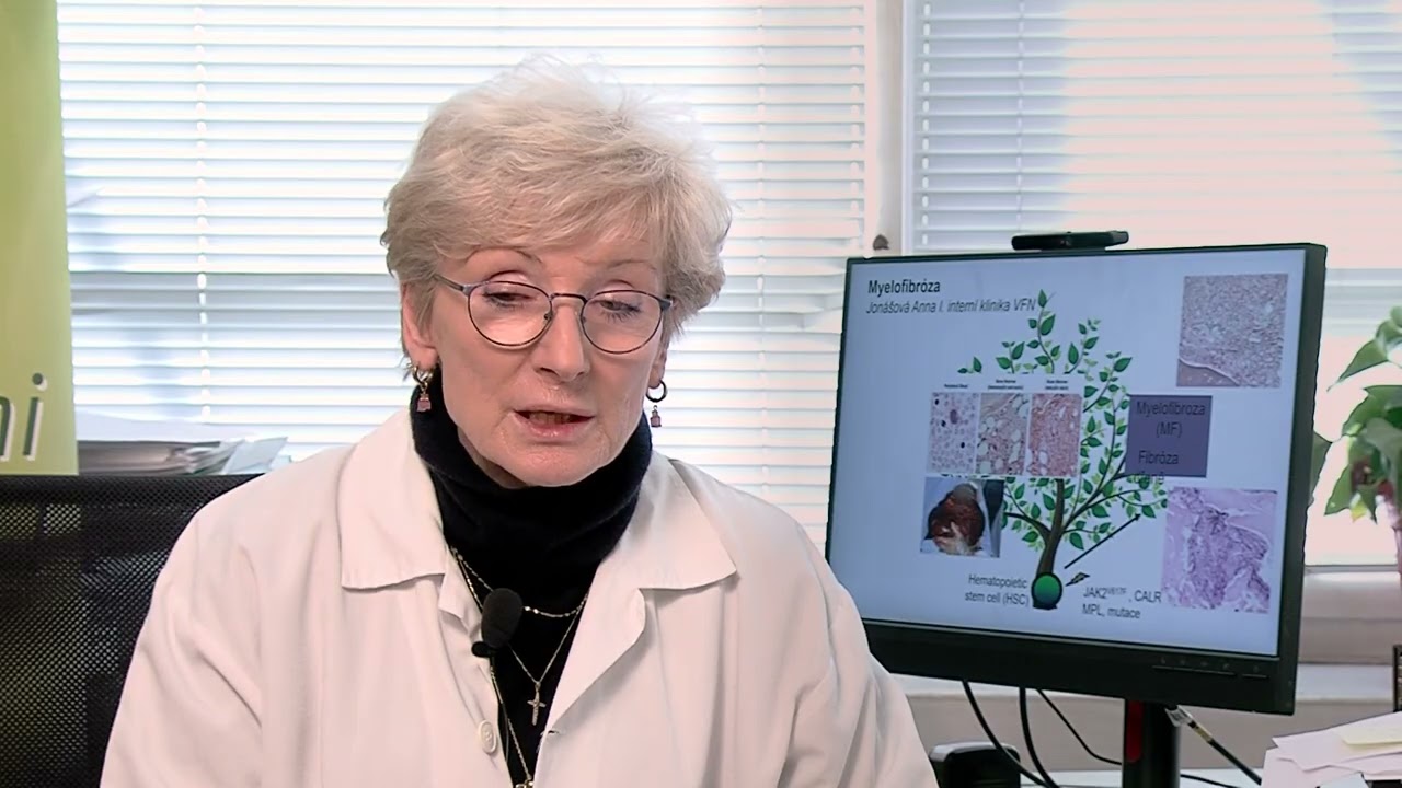 08. Volba léčby u myelofibrózy