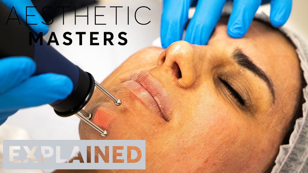 EXPLAINED: Cool Laser Rejuvenation Treatment | London