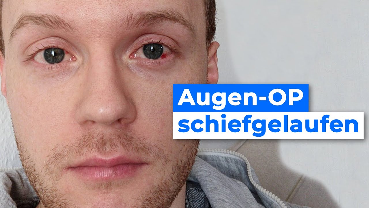 Ich habe meine Augen lasern lassen