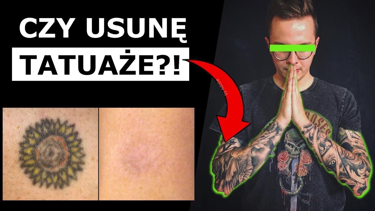 CZY BĘDĘ USUWAŁ TATUAŻE - TŁUMACZĘ MOJE DZIARY!