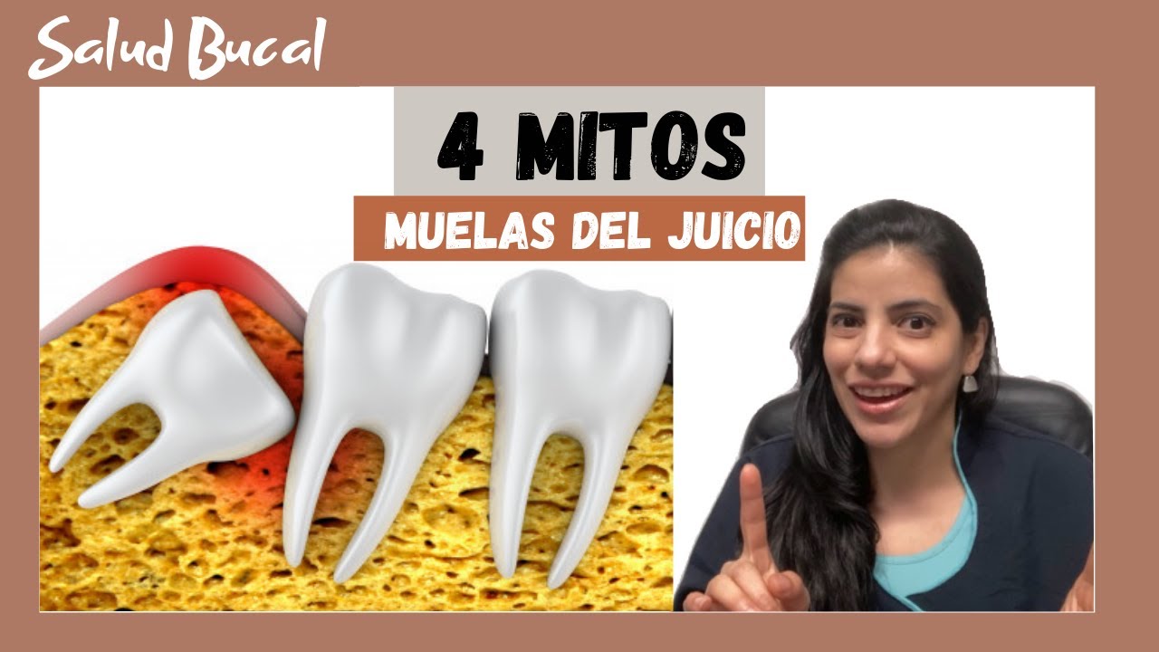 👉🏼Mitos de las muelas del Juicio