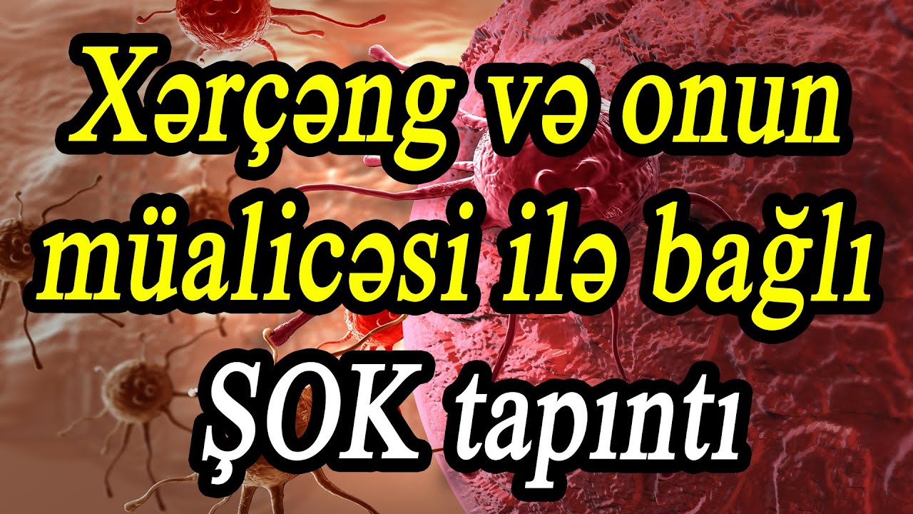 Xərçəng və onun müalicəsi ilə bağlı ŞOK tapıntı - Onkoloqdan xəstəliklə bağlı şok açıqlamalar