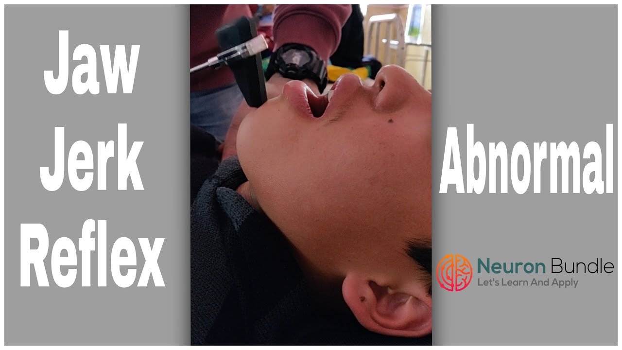 THE JAW JERK/ MASSETER REFLEX (Normal vs Abnormal  ) #MadeEasy #reflexes  #neurology