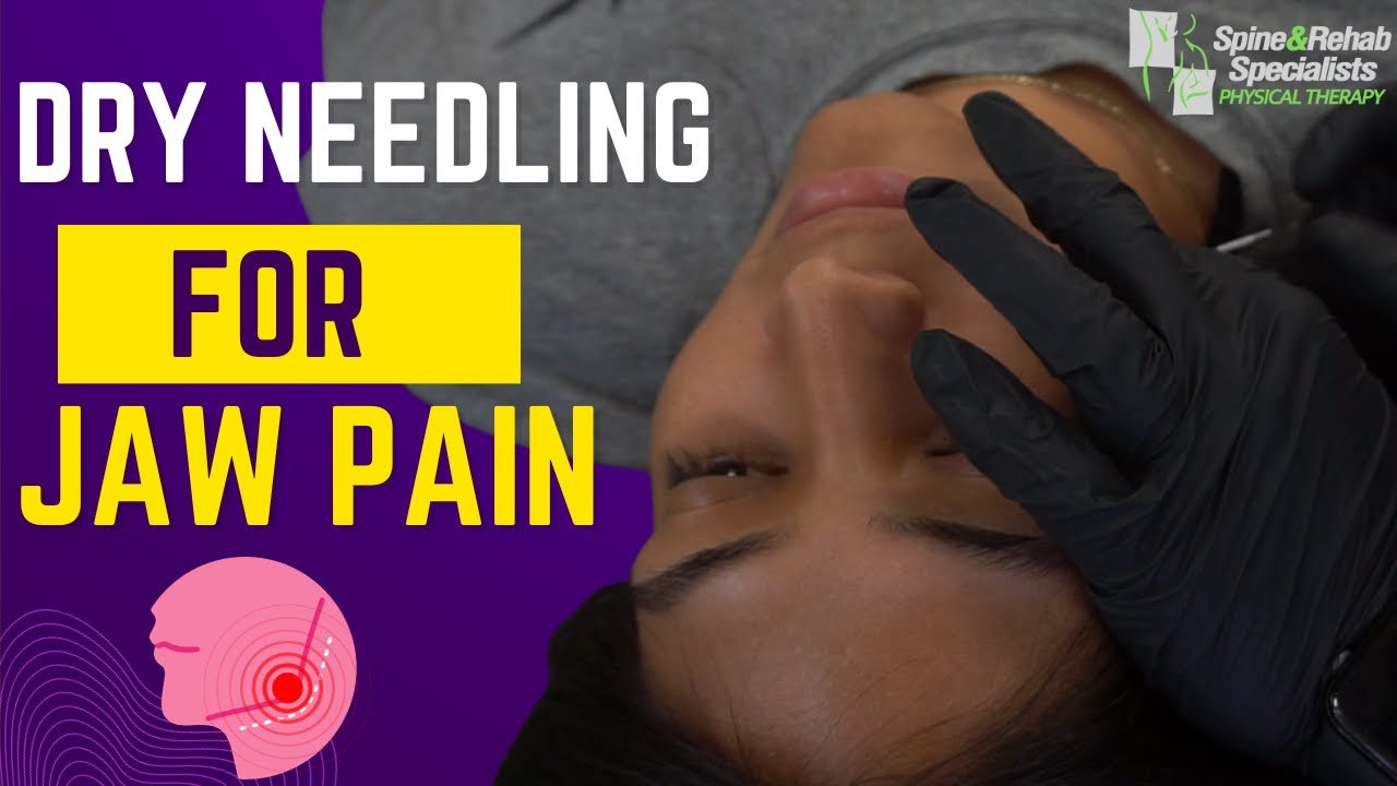 You Can Relieve TMJ Pain with Dry Needling!
