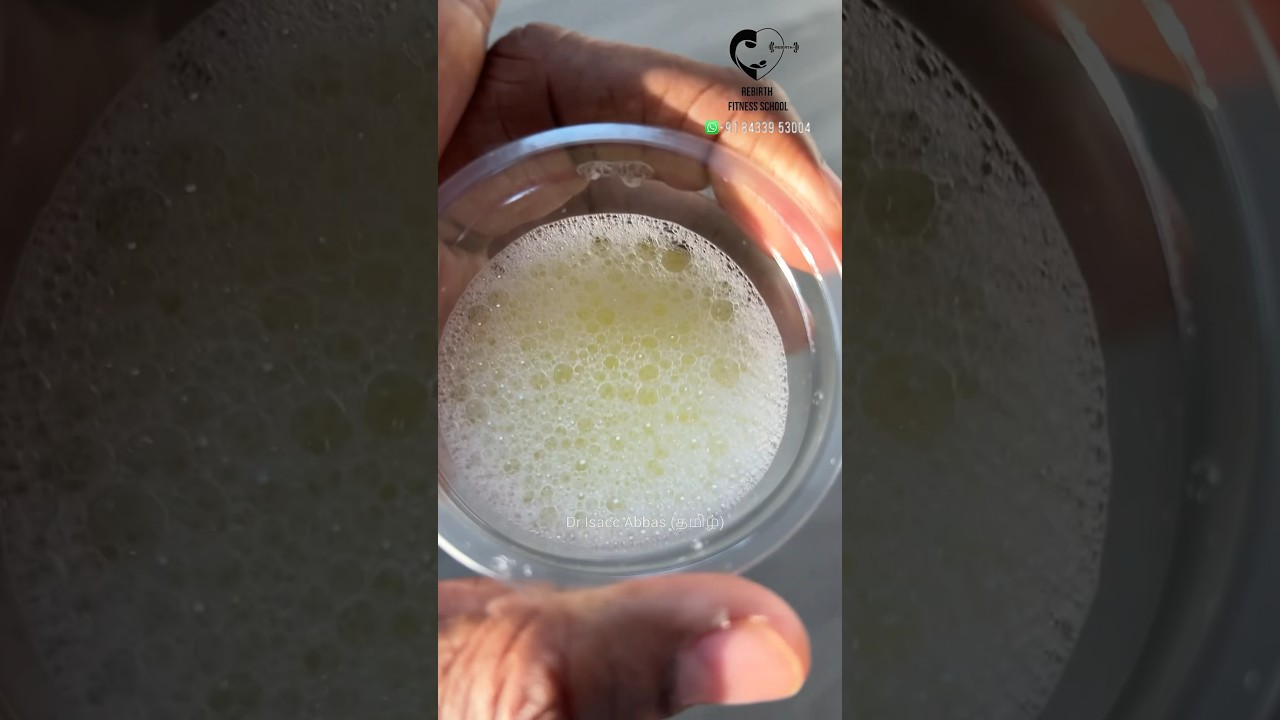 உங்கள் சிறுநீர் எந்த நிறத்தில் உள்ளது? Urine colour- Dr. Isacc Abbas