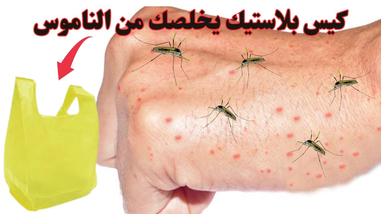 بدون مبيدات 🐞طرق مميزة وجبارة متوفرة فى كل منزل للتخلص من الناموس والذباب نهائي