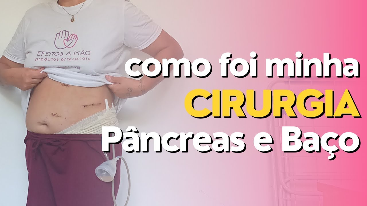 Minha Pancreatectomia e Esplenectomia