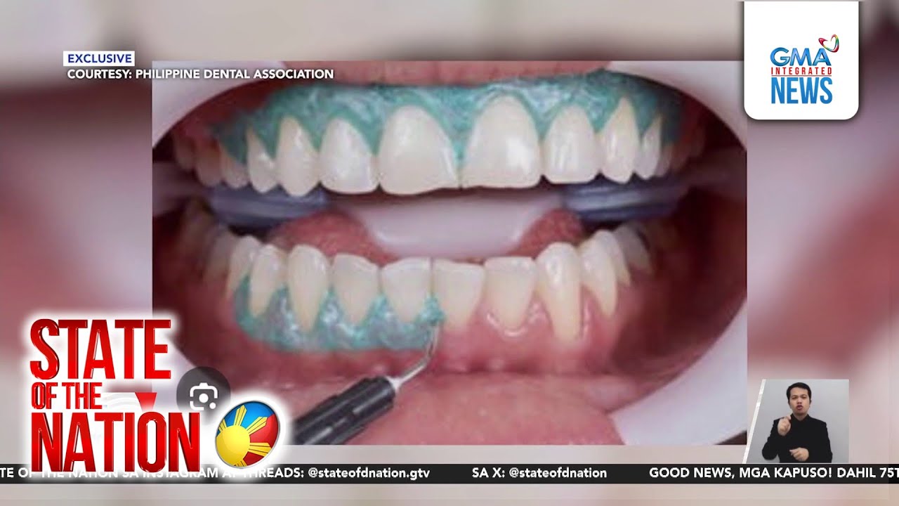 Fake dentist, fake priest nabbed in separate operations | SONA