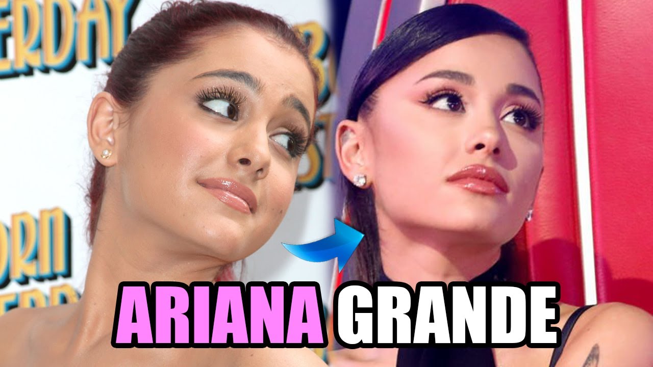 COMMENT ARIANA GRANDE EST DEVENUE SI BELLE ? Chirurgie esthétique ?