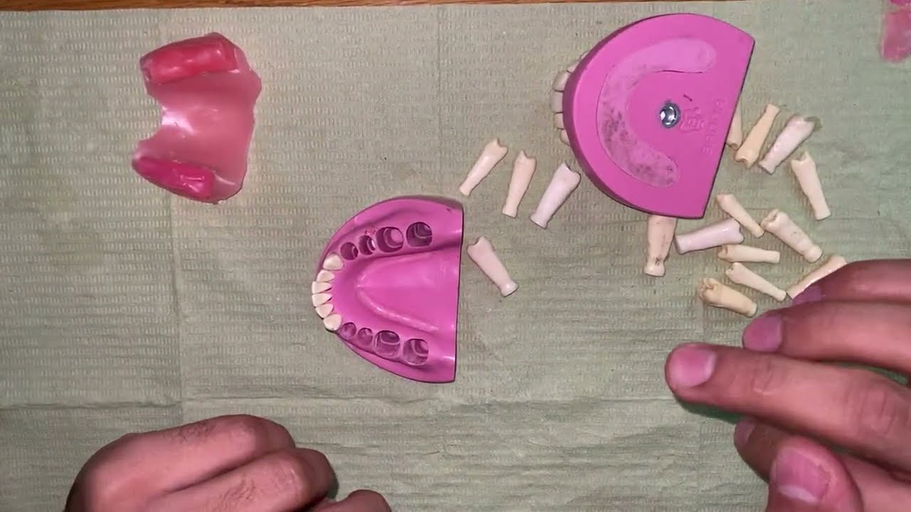 jaw relation for removable partial dentures 