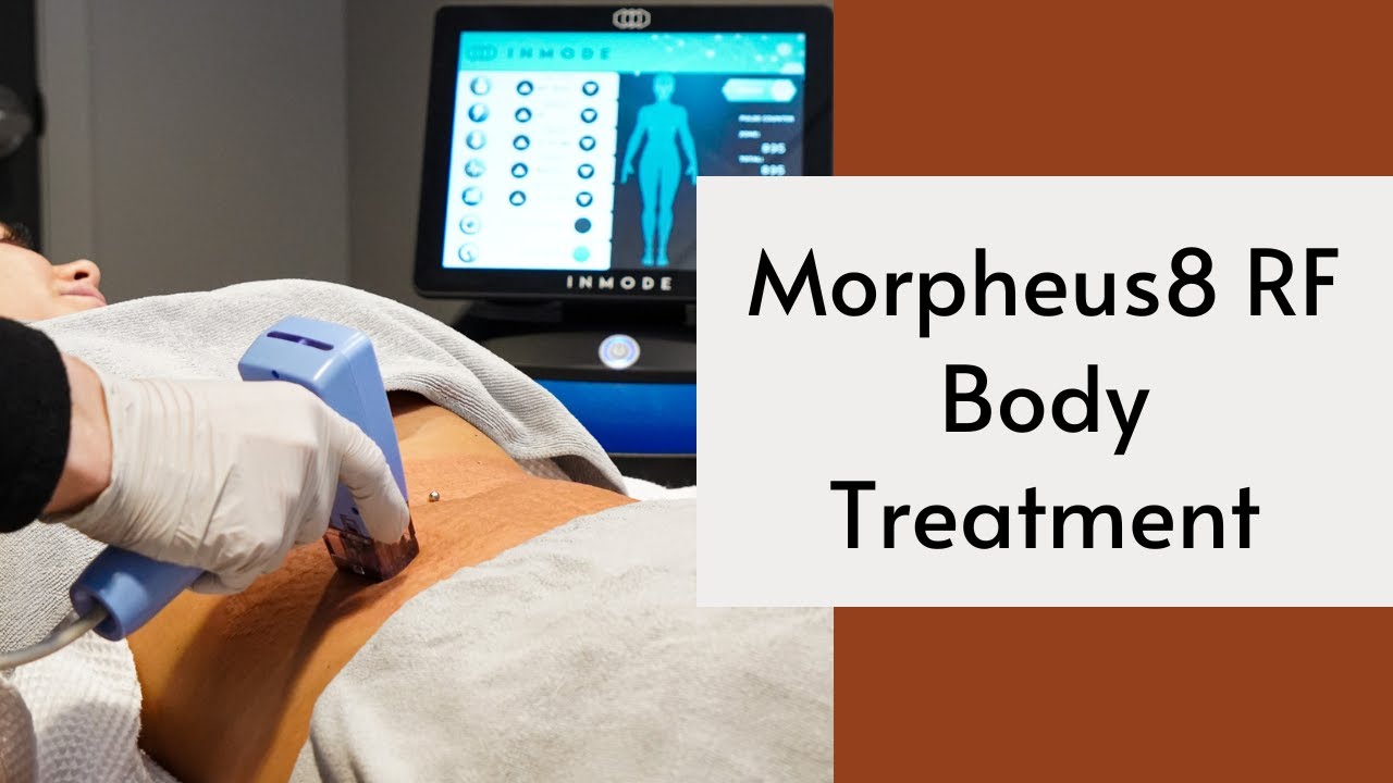 #morpheus8 Body Treatment for Cellulite and Skin Laxity