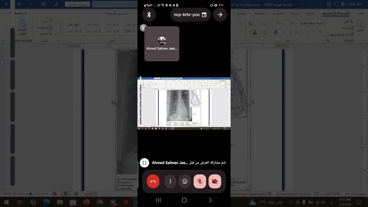شرح محاضرة الاولى مفراس كورس ثاني مرحلة رابعة اشعة   Cardiac and HRCT
