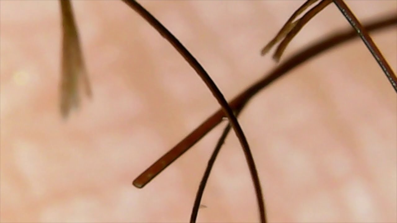 Split Ends and Breakage Under a Microscope