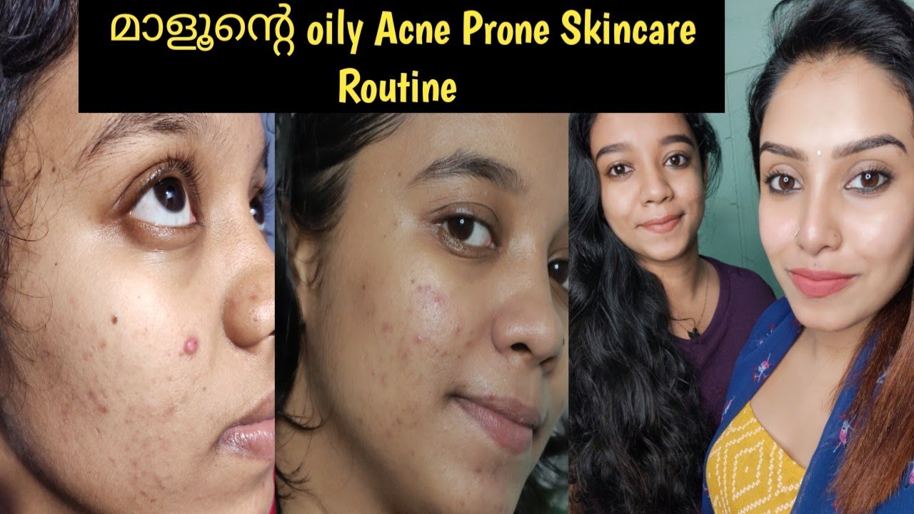 മാളൂന് ഏറ്റവും Result കിട്ടിയ skincare 💯 ~ Best Skincare Routine For OilyAcneProne Skin ~glamyganga