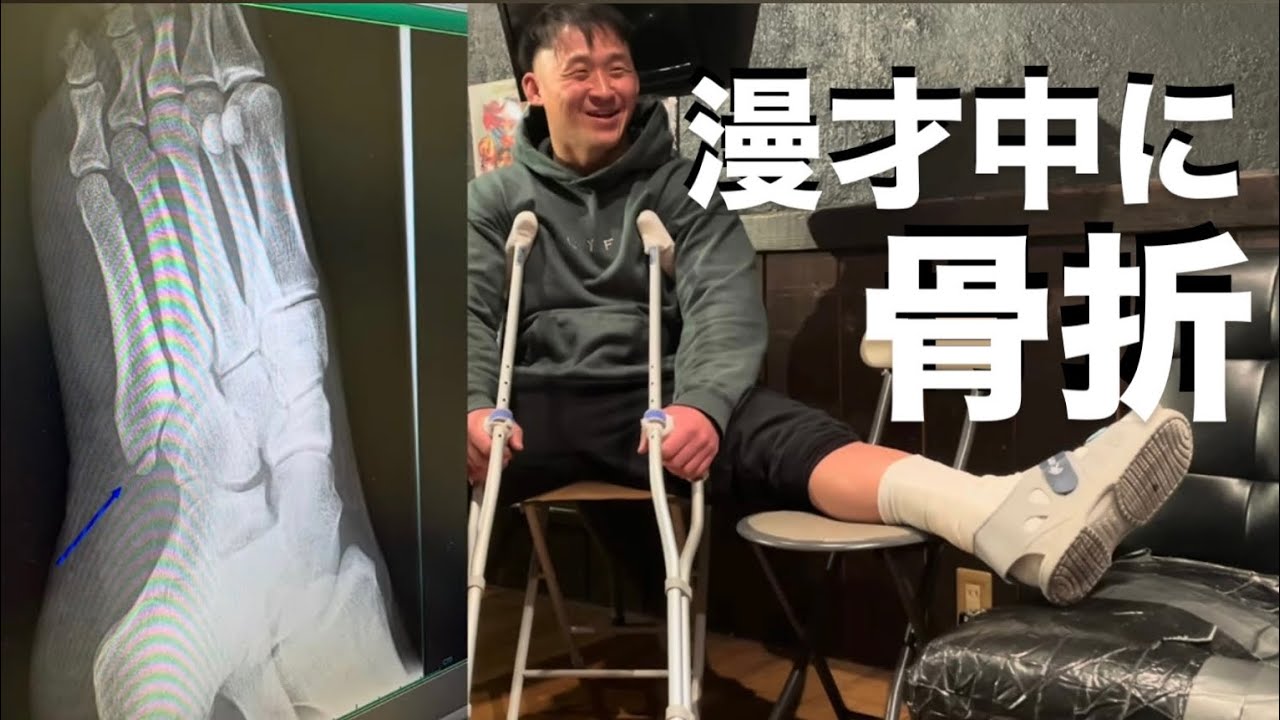 劇場所属の大事な舞台で漫才したら折れた！！！！！！【骨折】