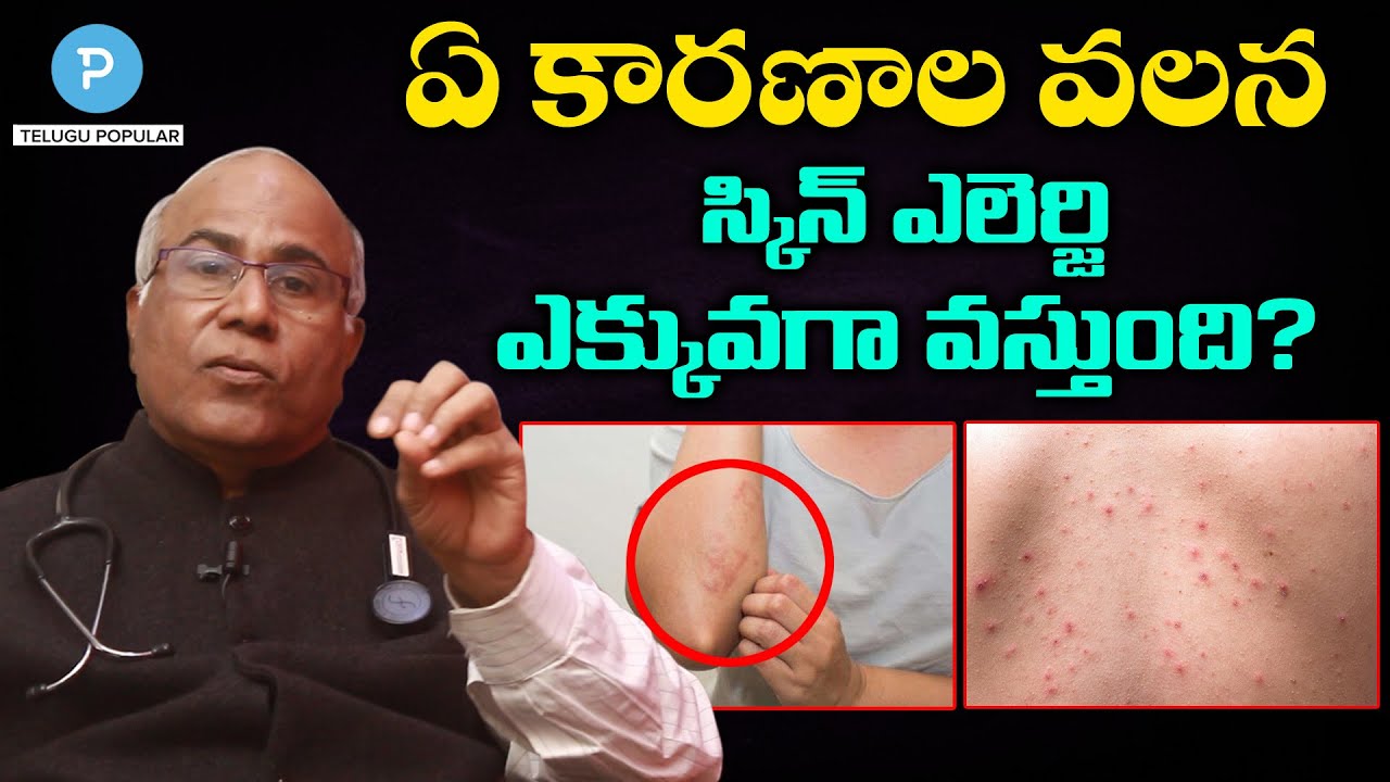ఏ కారణాల వలన స్కిన్ ఎలెర్జి ఎక్కువగా వస్తుంది? Skin Allergy by | Itching | Telugu Popular TV