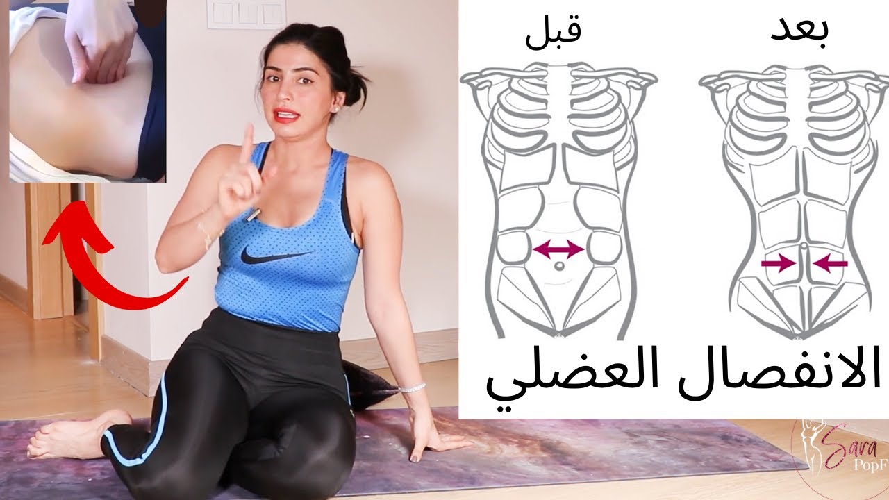 الانفصال العضلي | طريقة معرفته | حركات تجنبيها تماما !! | حركات تساعد على اغلاق الانفصال العضلي