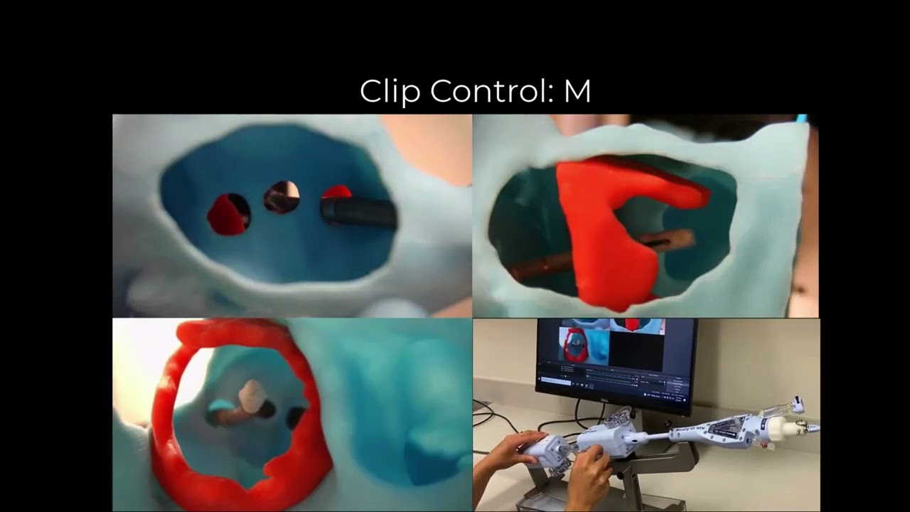 Overview of Virtual and Physical Image-Derived Modeling Pre-Intervention TEER Planning Workflow