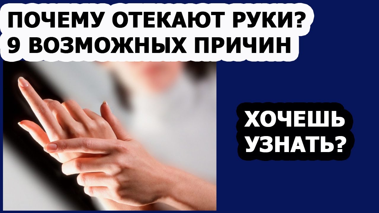 Отеки Почему отекают руки 9 возможных причин