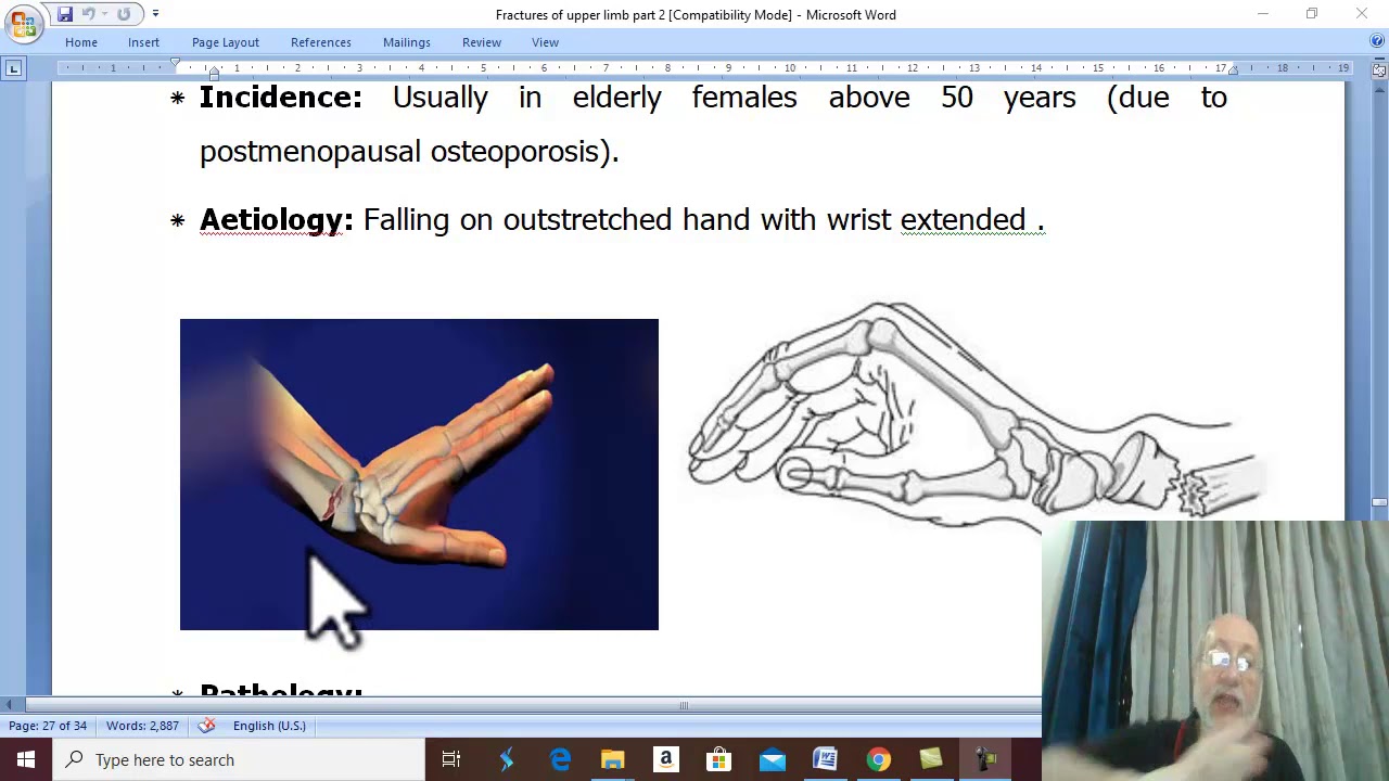 Orthopedic in  Arabic 23( Colles' fracture , part 1 ) , by Dr. Wahdan