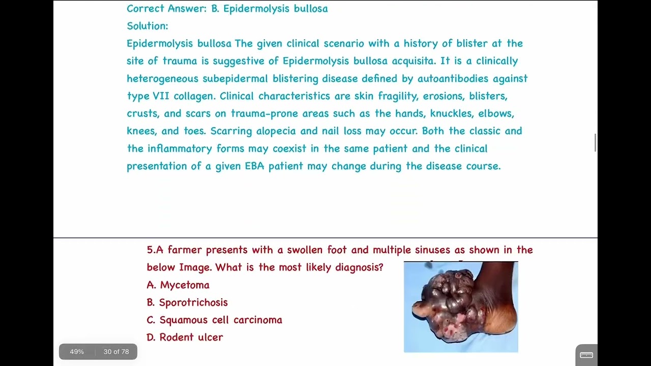 Dermatology PYQ Recall AIIMS 2020 #inicet #inicetrecall #aiims2020 #aiims