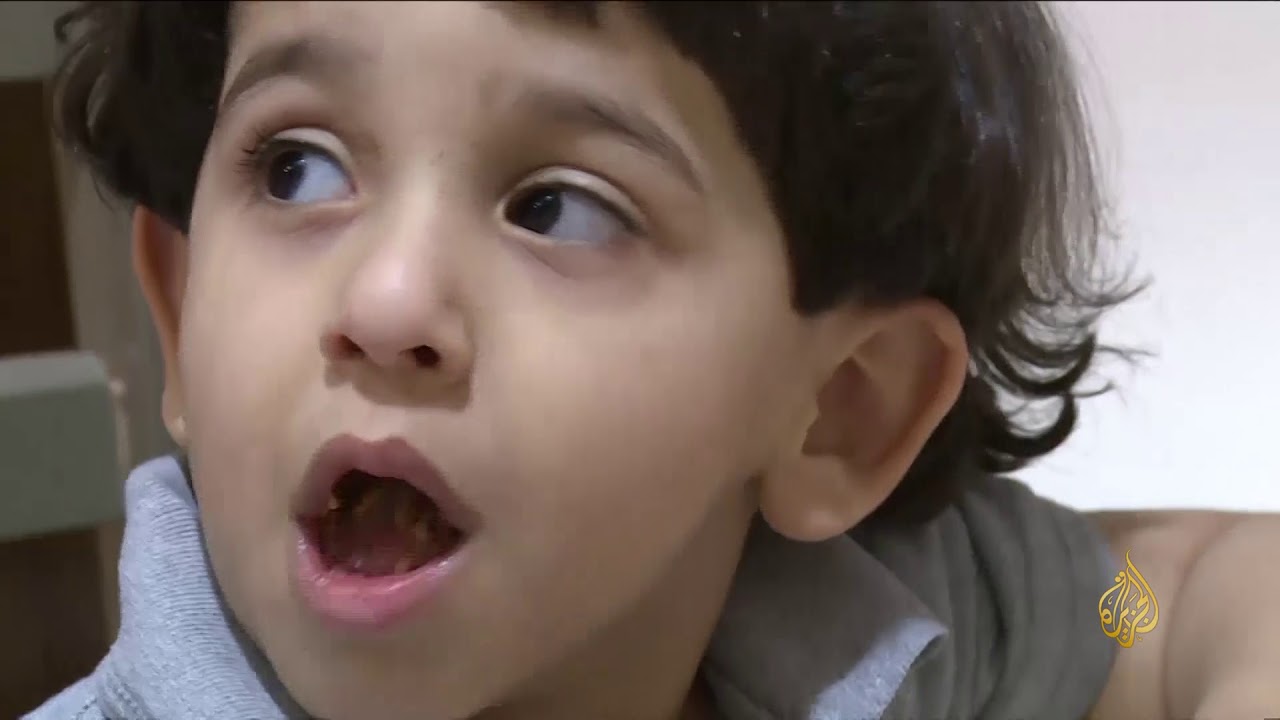 هذا الصباح-أطفال التوحد.. لمسات إبداع تنشد من ينميها