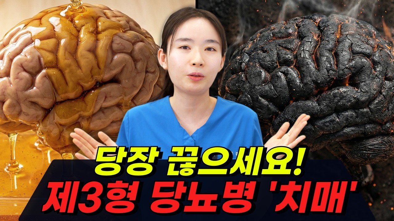 치매가 '제3형 당뇨병'이라고 불리는 이유, 밥먹고 '이것' 하면 뇌세포가 죽습니다!