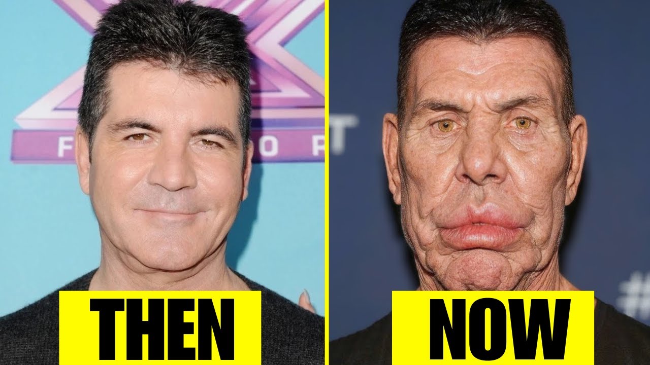 10 Shocking Failed Cosmetic Surgery Cases of Celebrities You Won't Believe | Then and Now 2026
