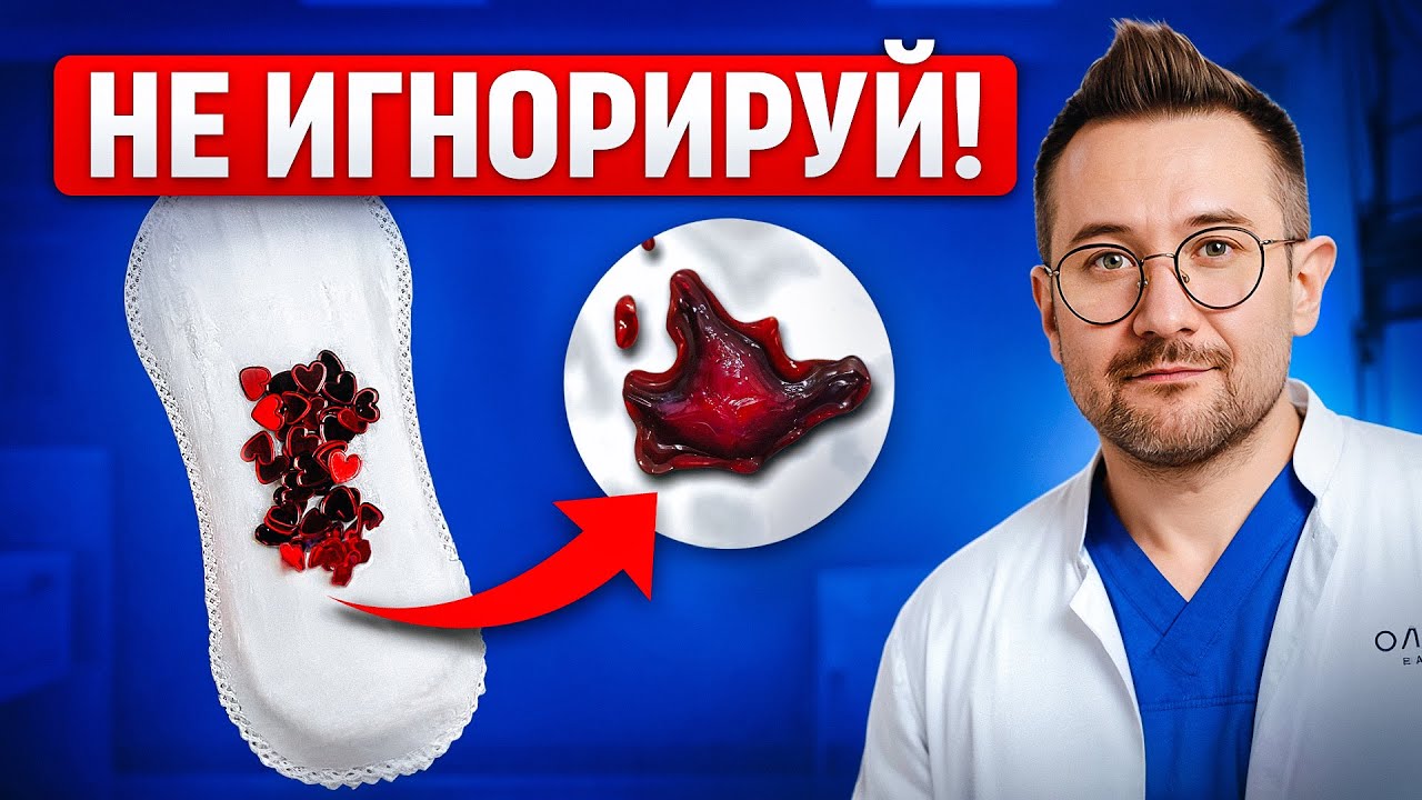 СГУСТКИ ПРИ МЕНСТРУАЦИИ: Что вам недоговаривают? Признаки здоровых месячных
