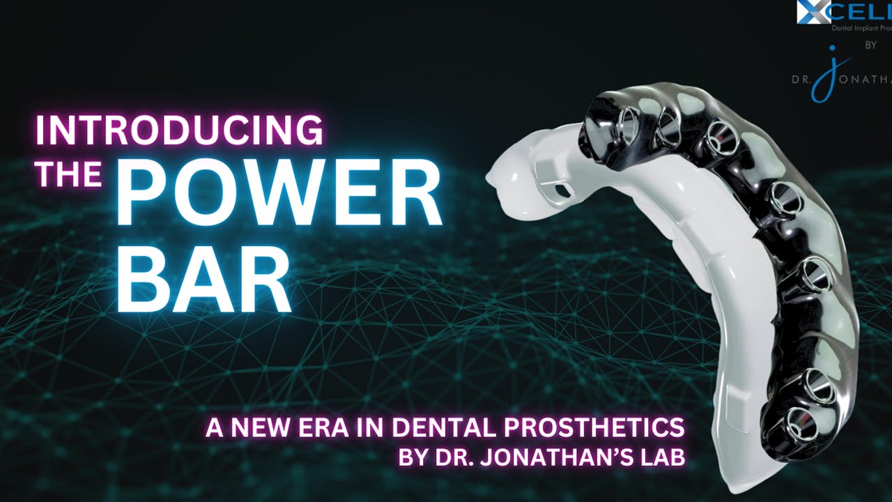 Titanium bars Power bar dental implants how do you do it ??