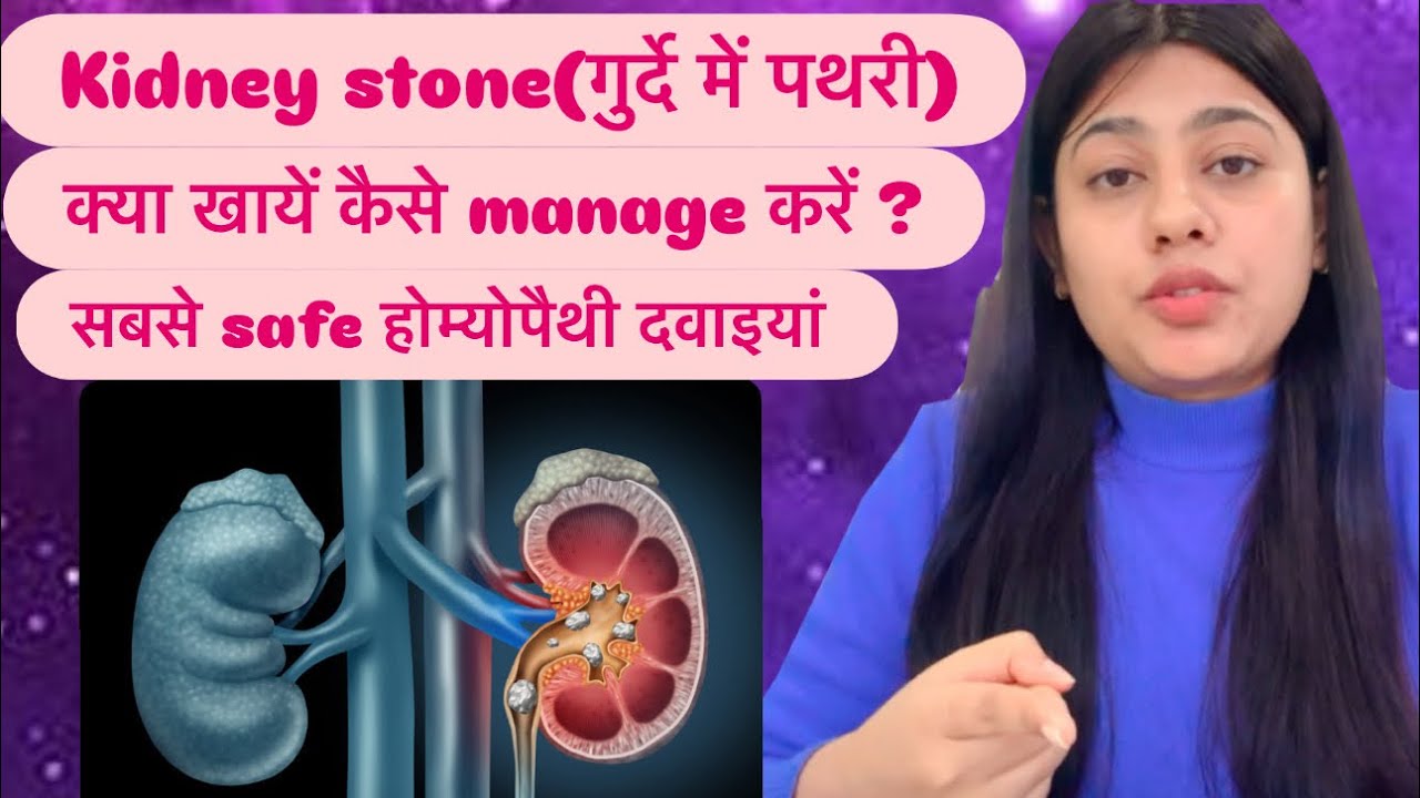 Kidney stone ( पथरी) की पूरी जानकारी । by dr bharti 🙂