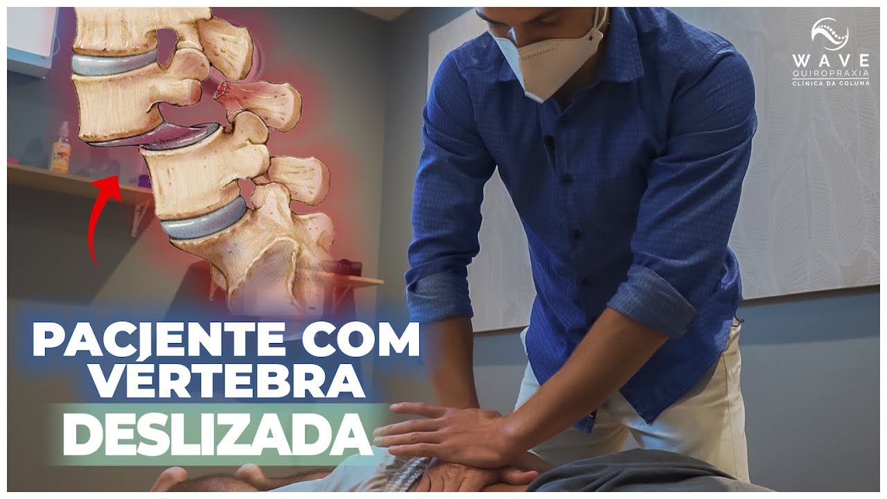 TRATANDO ESCORREGAMENTO DA VÉRTEBRA COM QUIROPRAXIA