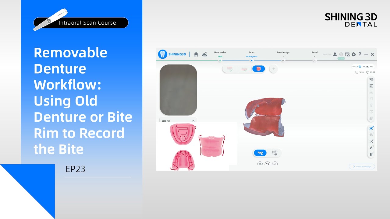 Intraoral Scan Course EP23｜Removable Denture Workflow:  Old Denture or Bite Rim to Record the Bite