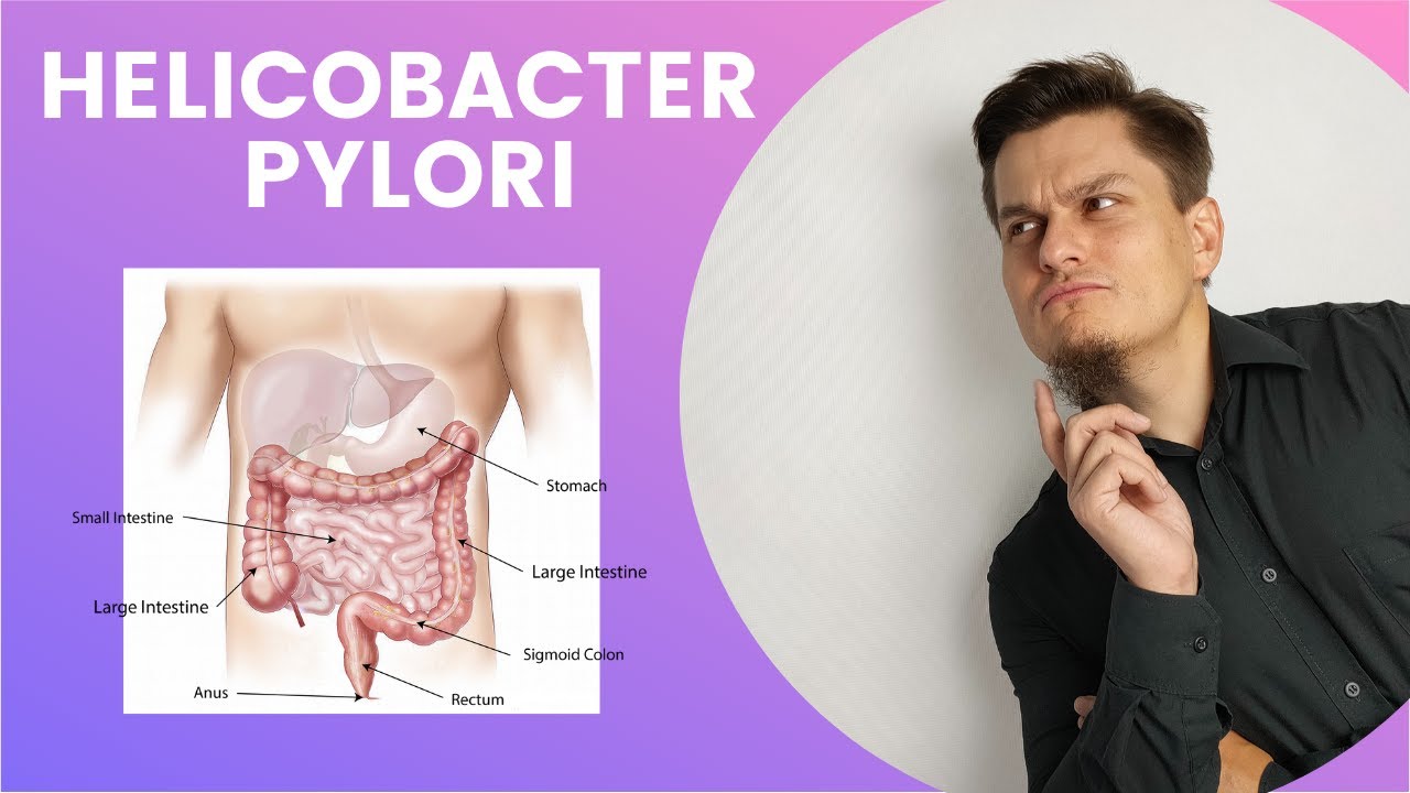 Choroba wrzodowa: Helicobacter Pylori. Objawy Diagnoza Leczenie Dieta