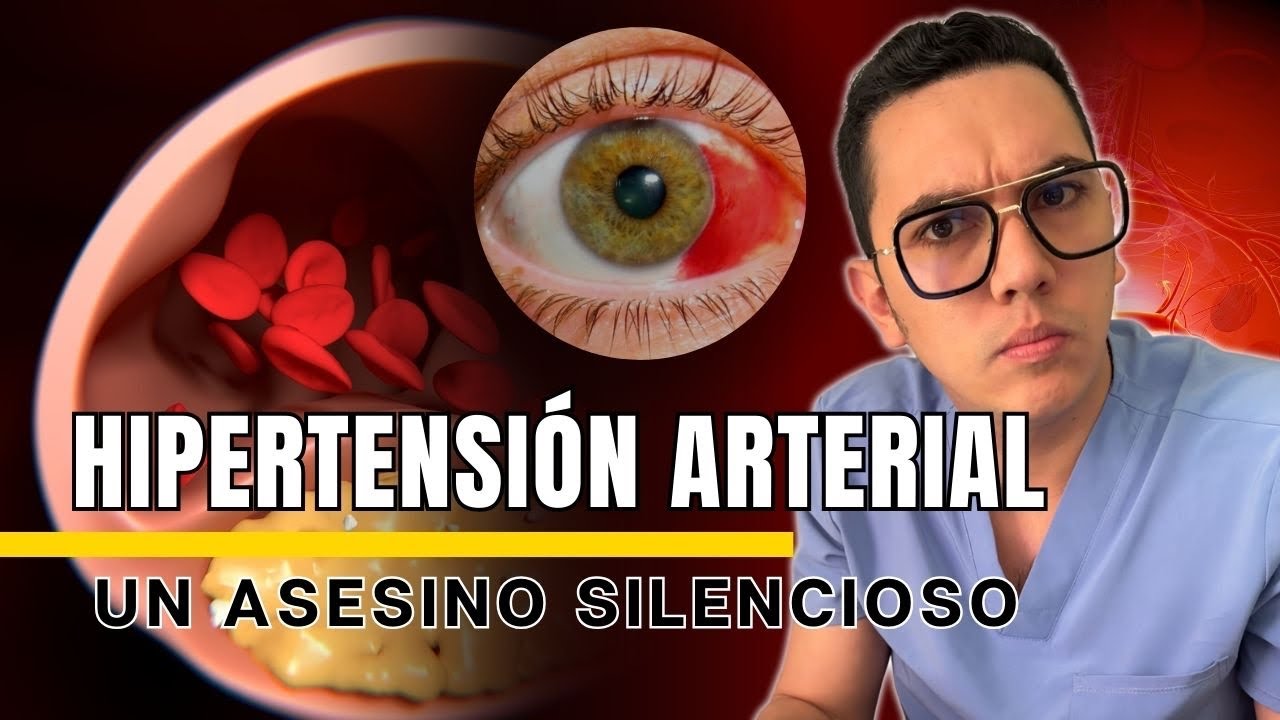 Hipertensión arterial, un asesino silencioso al acecho | Dr. William Guerrero