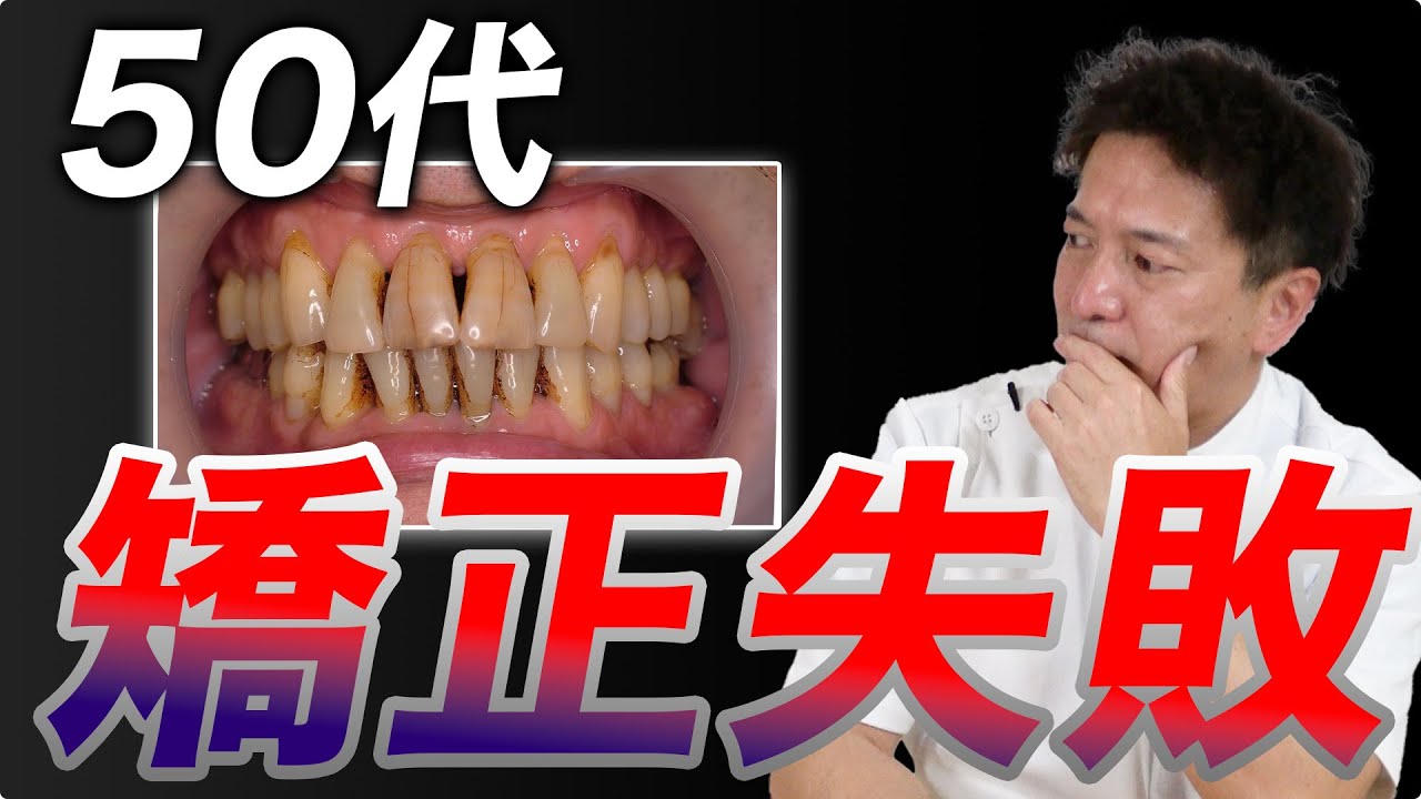 【50代】歯列矯正が失敗する本当の原因【知らないと危険】